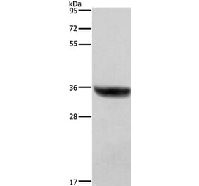 HSD17B1 Antibody from Signalway Antibody (37635) - Antibodies.com