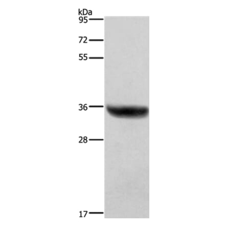 HSD17B1 Antibody from Signalway Antibody (37635) - Antibodies.com