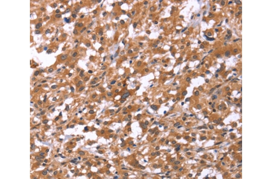 Immunohistochemistry - HSD17B1 Antibody from Signalway Antibody (37635) - Antibodies.com