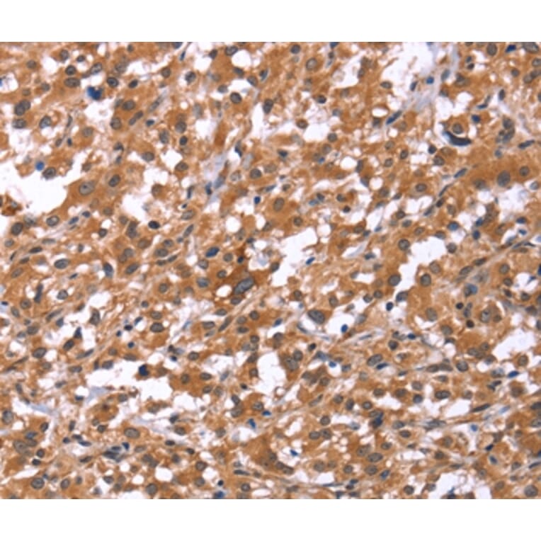 Immunohistochemistry - HSD17B1 Antibody from Signalway Antibody (37635) - Antibodies.com