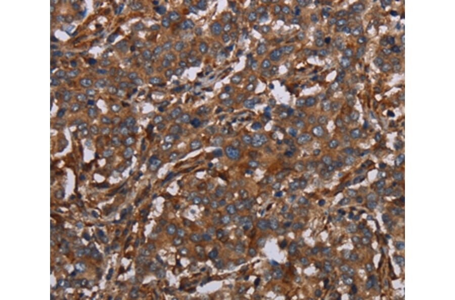 Immunohistochemistry - MAP3K11 Antibody from Signalway Antibody (37733) - Antibodies.com