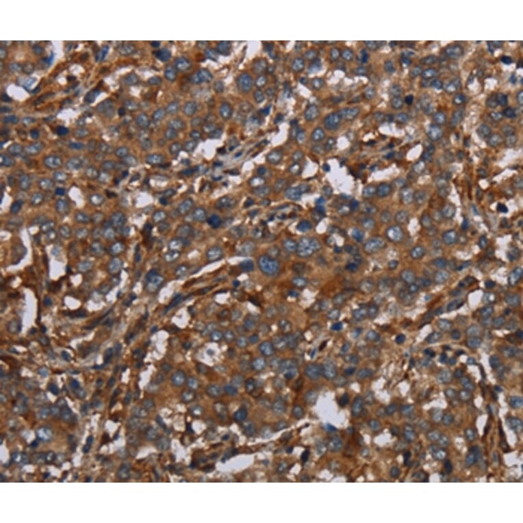 Immunohistochemistry - MAP3K11 Antibody from Signalway Antibody (37733) - Antibodies.com