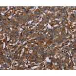 Immunohistochemistry - MAP3K11 Antibody from Signalway Antibody (37733) - Antibodies.com