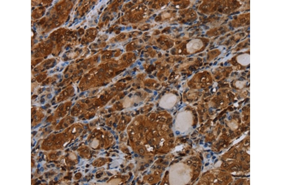 Immunohistochemistry - MYBBP1A Antibody from Signalway Antibody (37746) - Antibodies.com