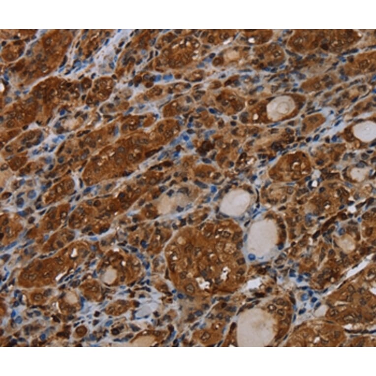 Immunohistochemistry - MYBBP1A Antibody from Signalway Antibody (37746) - Antibodies.com