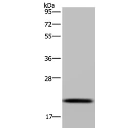NDUFAF4 Antibody from Signalway Antibody (37756) - Antibodies.com