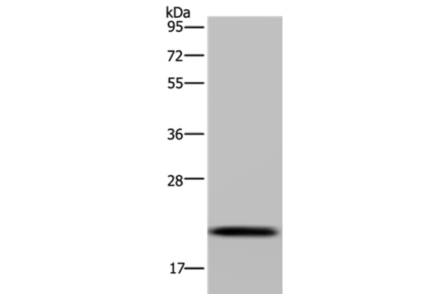 NDUFAF4 Antibody from Signalway Antibody (37756) - Antibodies.com