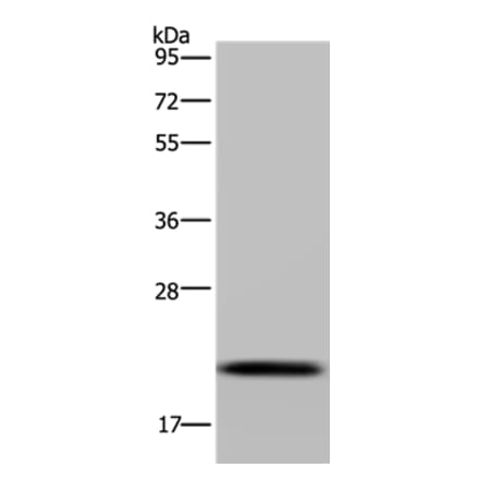 NDUFAF4 Antibody from Signalway Antibody (37756) - Antibodies.com