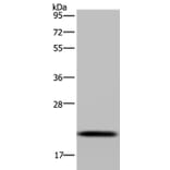 NDUFAF4 Antibody from Signalway Antibody (37756) - Antibodies.com