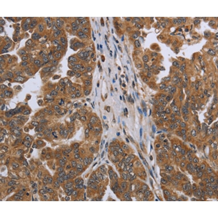 Immunohistochemistry - NDUFAF4 Antibody from Signalway Antibody (37756) - Antibodies.com