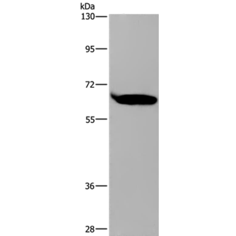 SLC22A2 Antibody from Signalway Antibody (37782) - Antibodies.com