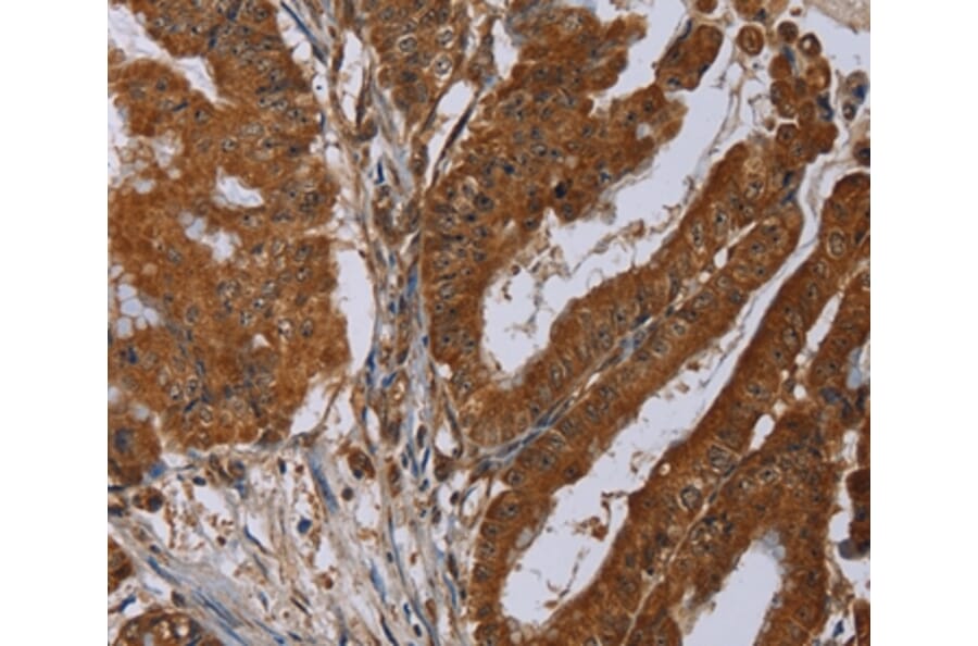 Immunohistochemistry - SLC22A2 Antibody from Signalway Antibody (37782) - Antibodies.com