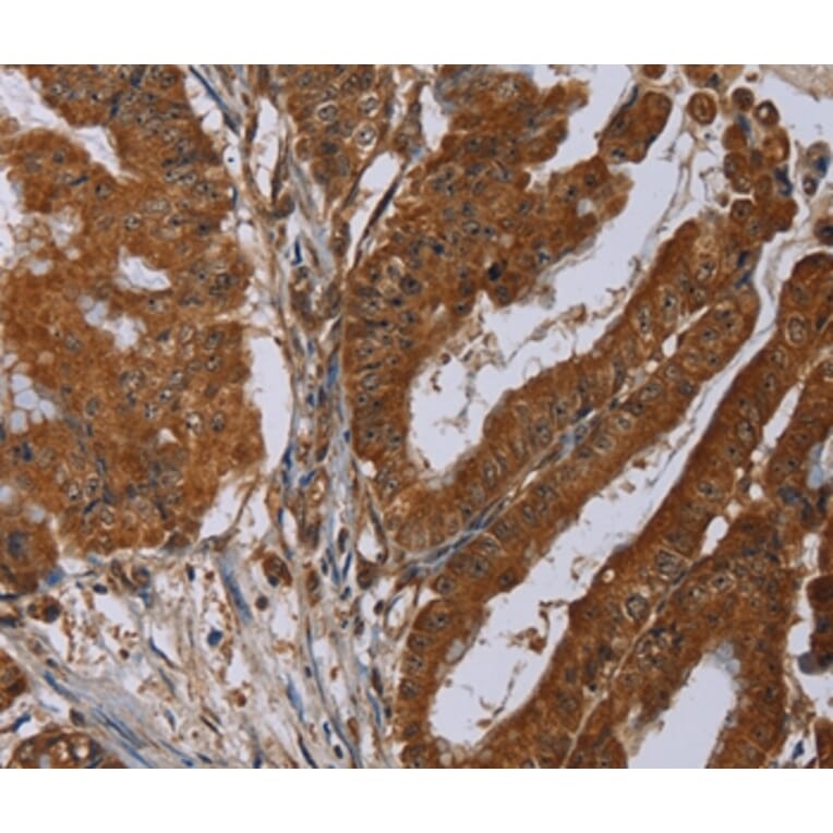 Immunohistochemistry - SLC22A2 Antibody from Signalway Antibody (37782) - Antibodies.com