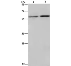 RPS6KB2 Antibody from Signalway Antibody (37792) - Antibodies.com