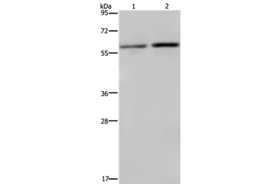RPS6KB2 Antibody from Signalway Antibody (37792) - Antibodies.com
