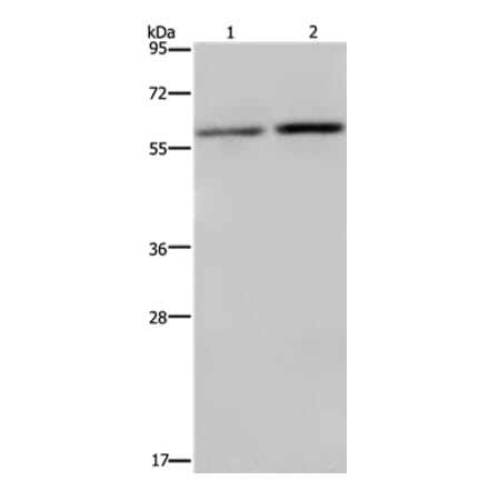 RPS6KB2 Antibody from Signalway Antibody (37792) - Antibodies.com