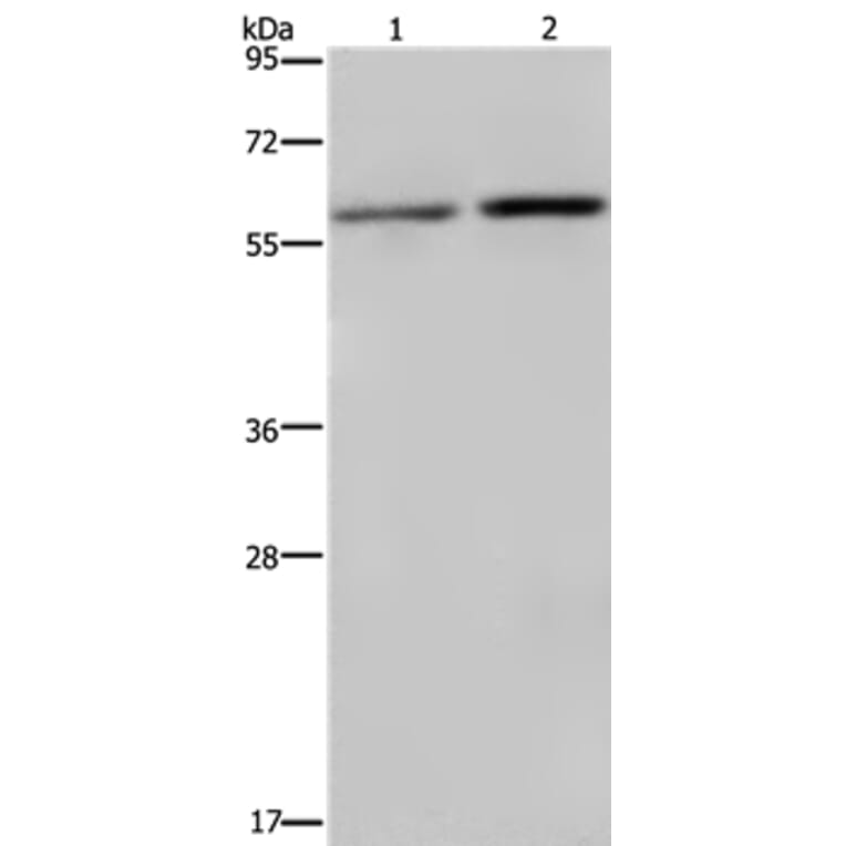 RPS6KB2 Antibody from Signalway Antibody (37792) - Antibodies.com