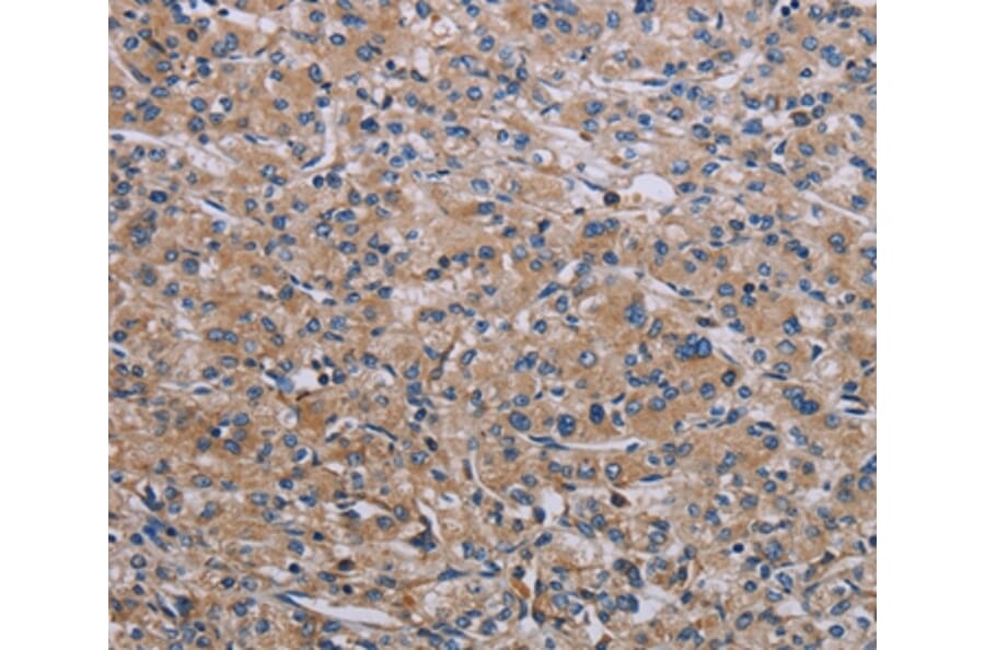 Immunohistochemistry - RPS6KB2 Antibody from Signalway Antibody (37792) - Antibodies.com