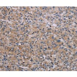 Immunohistochemistry - RPS6KB2 Antibody from Signalway Antibody (37792) - Antibodies.com