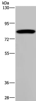 Gel: 6%SDS-PAGE Lysate: 40ug K562 cell Primary antibody: 1/200 dilution Secondary antibody dilution: 1/8000 Exposure time: 1 minute