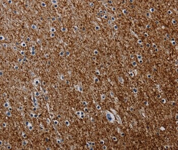 Immunohistochemical analysis of paraffin-embedded Human brain tissue using #37802 at dilution 1/50.