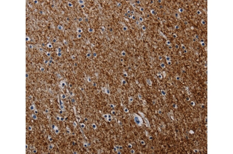 Immunohistochemistry - PCDHAC1 Antibody from Signalway Antibody (37802) - Antibodies.com