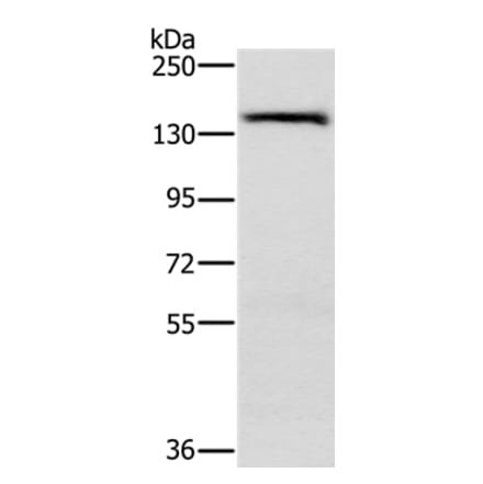 PPP2R3A Antibody from Signalway Antibody (37845) - Antibodies.com