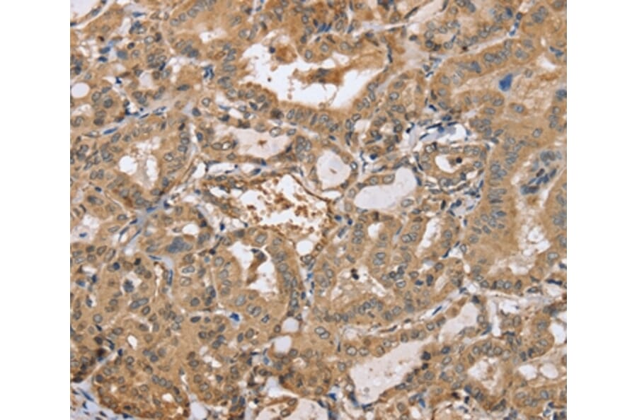Immunohistochemistry - PPP2R3A Antibody from Signalway Antibody (37845) - Antibodies.com