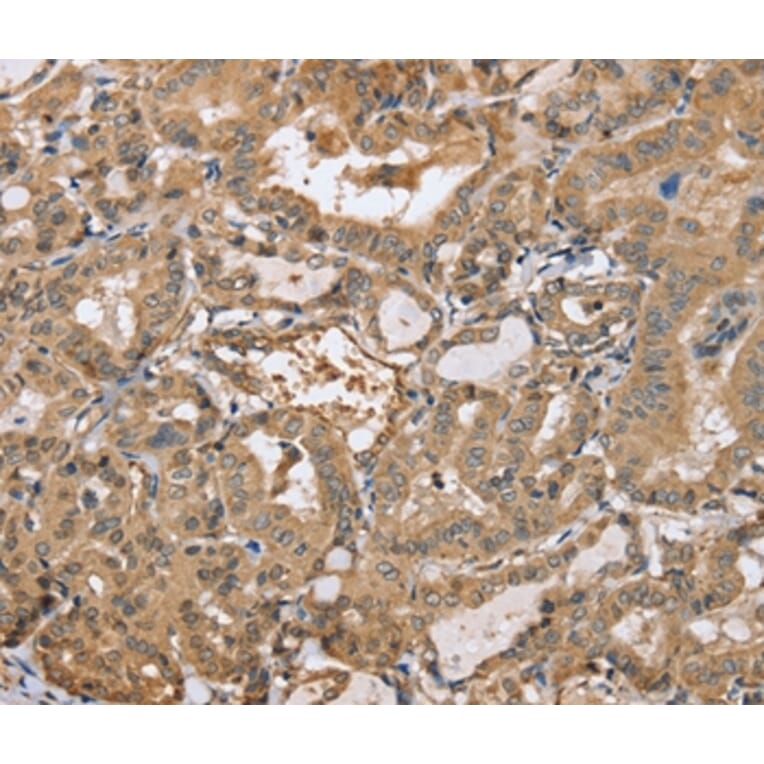 Immunohistochemistry - PPP2R3A Antibody from Signalway Antibody (37845) - Antibodies.com