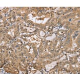 Immunohistochemistry - PPP2R3A Antibody from Signalway Antibody (37845) - Antibodies.com