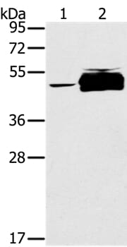 Gel: 8% SDS-PAGE Lysates (from left to right): K562 cell and human testis tissue Amount of lysate: 40ug per lane Primary antibody: 1/200 dilution Secondary antibody dilution: 1/8000 Exposure time: 1 minute