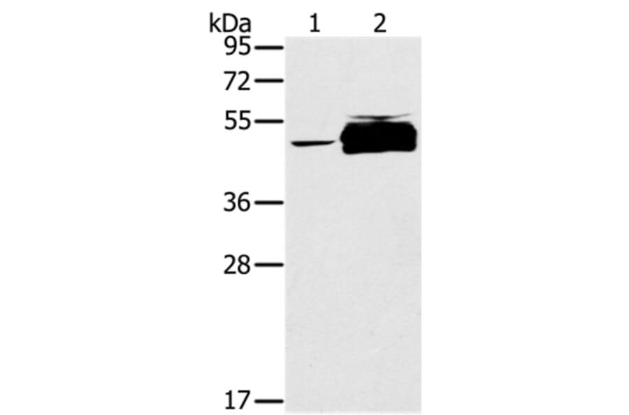 PTPN20B Antibody from Signalway Antibody (37850) - Antibodies.com