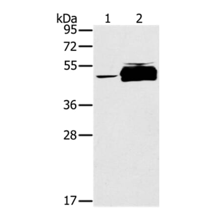 PTPN20B Antibody from Signalway Antibody (37850) - Antibodies.com