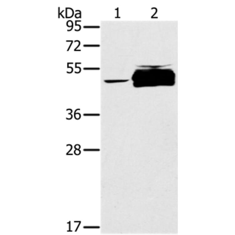 PTPN20B Antibody from Signalway Antibody (37850) - Antibodies.com