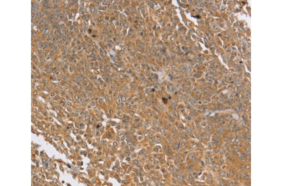 Immunohistochemistry - PTPN20B Antibody from Signalway Antibody (37850) - Antibodies.com