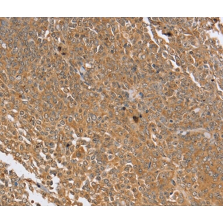 Immunohistochemistry - PTPN20B Antibody from Signalway Antibody (37850) - Antibodies.com