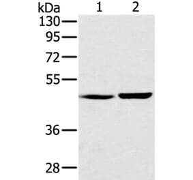 SEC14L2 Antibody from Signalway Antibody (37904) - Antibodies.com