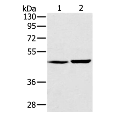 SEC14L2 Antibody from Signalway Antibody (37904) - Antibodies.com