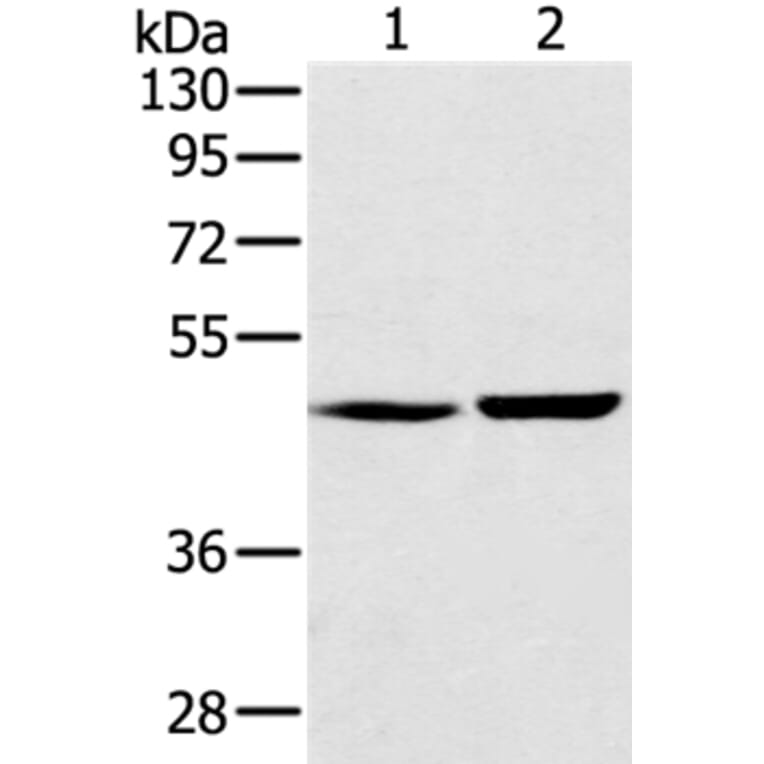 SEC14L2 Antibody from Signalway Antibody (37904) - Antibodies.com