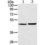 SEC14L2 Antibody from Signalway Antibody (37904) - Antibodies.com