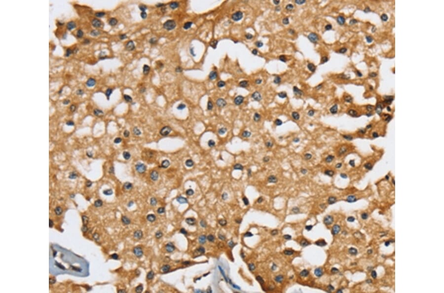Immunohistochemistry - SEC14L2 Antibody from Signalway Antibody (37904) - Antibodies.com