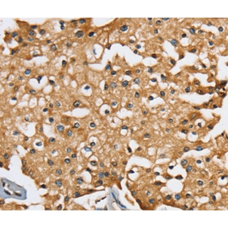 Immunohistochemistry - SEC14L2 Antibody from Signalway Antibody (37904) - Antibodies.com