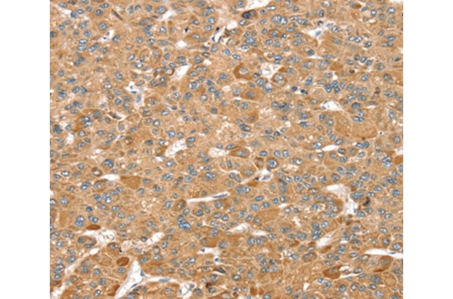 Immunohistochemistry - MORF4L1 Antibody from Signalway Antibody (37909) - Antibodies.com