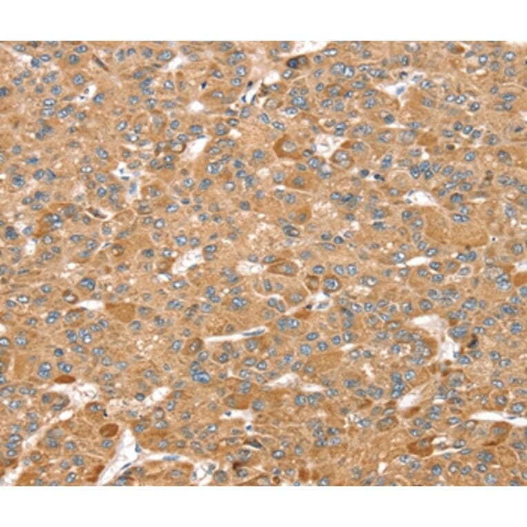 Immunohistochemistry - MORF4L1 Antibody from Signalway Antibody (37909) - Antibodies.com