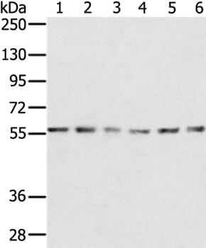 Gel: 8% SDS-PAGE Lysates (from left to right): K562, NIH/3T3, Jurkat, 293T, 231 and hepg2 cell Amount of lysate: 40ug per lane Primary antibody: 1/200 dilution Secondary antibody dilution: 1/8000 Exposure time: 1 minute