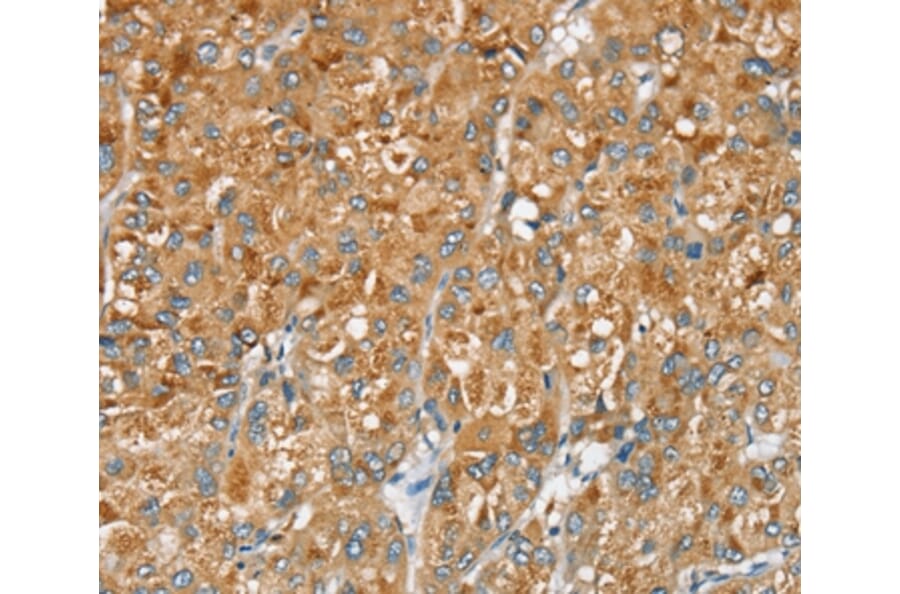 Immunohistochemistry - SERINC2 Antibody from Signalway Antibody (37912) - Antibodies.com