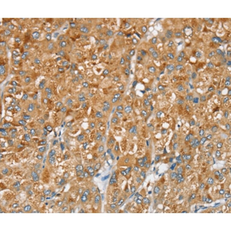 Immunohistochemistry - SERINC2 Antibody from Signalway Antibody (37912) - Antibodies.com