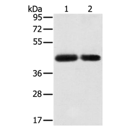 SLC16A3 Antibody from Signalway Antibody (37928) - Antibodies.com