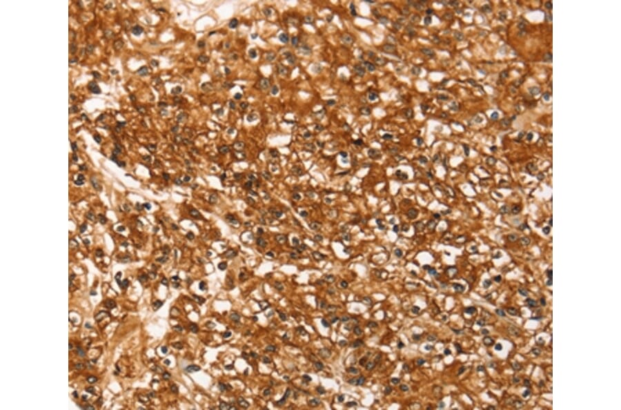 Immunohistochemistry - SLC16A3 Antibody from Signalway Antibody (37928) - Antibodies.com