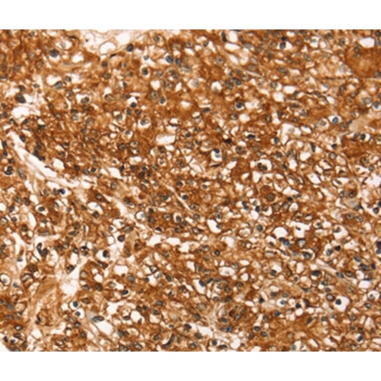 Immunohistochemistry - SLC16A3 Antibody from Signalway Antibody (37928) - Antibodies.com